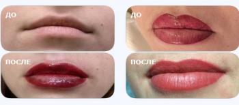 напыление губ тверь