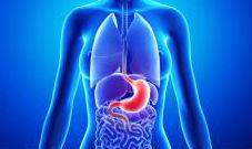 рак желудка